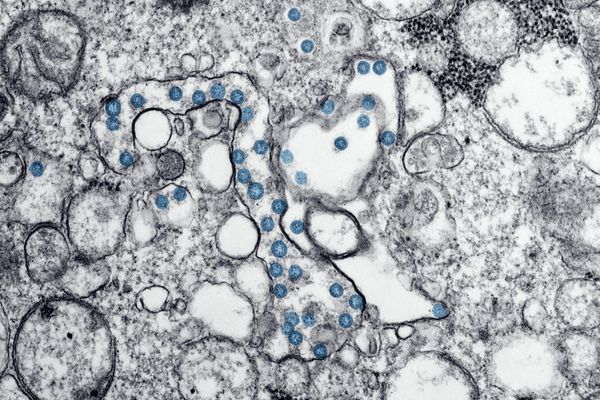 Microscopic visualization of healthy cells and nutrients